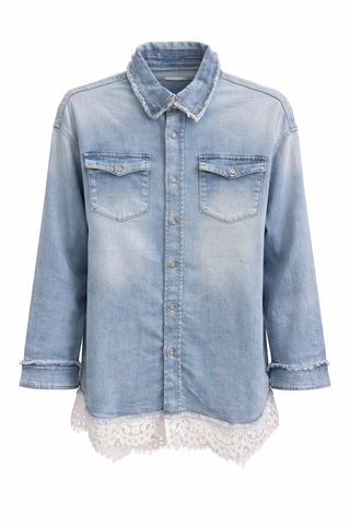 Soft Edge Lace Button Dawn Top