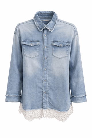Soft Edge Lace Button Dawn Top